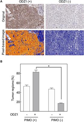 Hypoxia Can Induce Migration of Glioblastoma Cells Through a Methylation-Dependent Control of ODZ1 Gene Expression